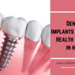 Dental implants and your Health go hand in hand